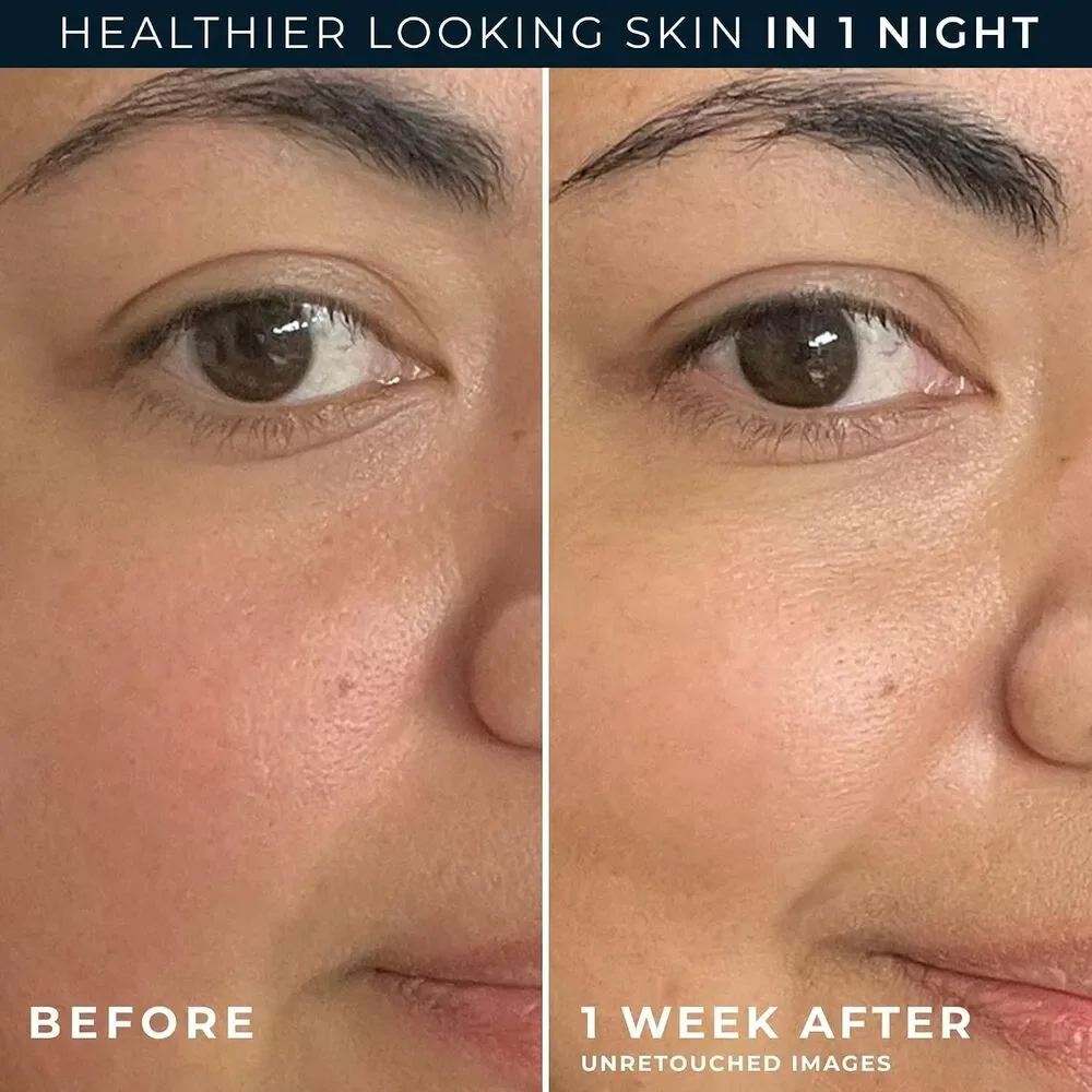 RoC Skin Barrier Renew Night Moisturizer with Ceramides & Peptides White 2.5 oz